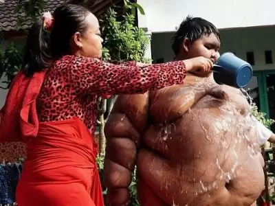 ni�o-gordo