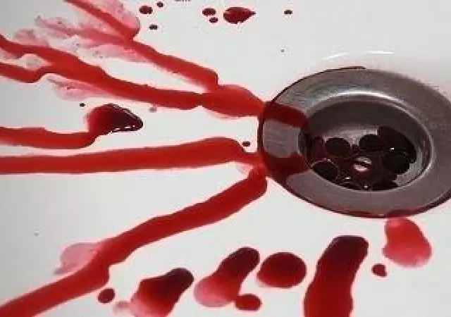 ba�era-sangre-crimen-mujer-c�rdoba-femicidios