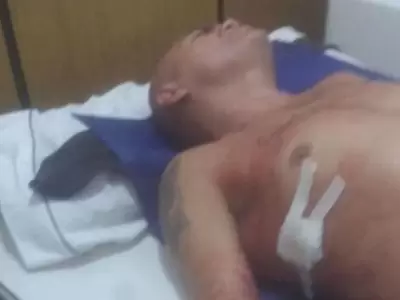 hiena-barrios-agresor-ataque-fotos-video