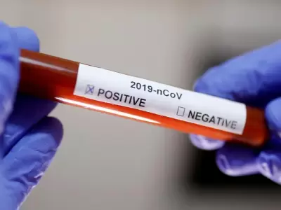 Coronavirus