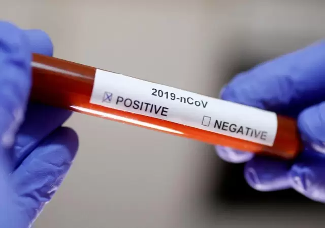 Coronavirus