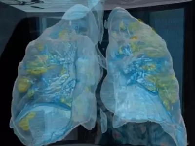 coronavirus-video-pulmones