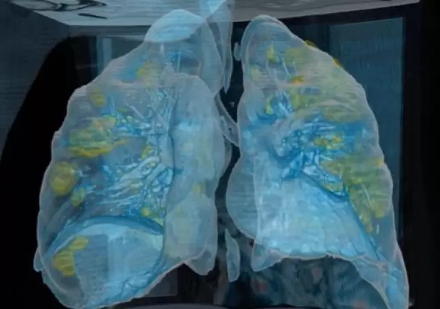 coronavirus-video-pulmones