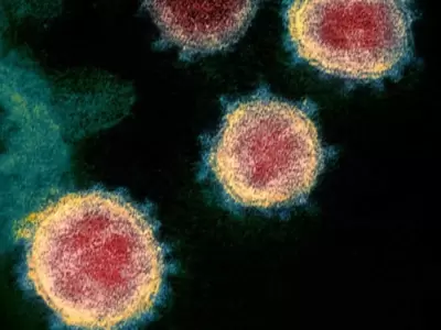 coronavirus-5