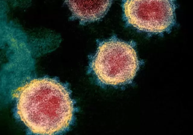 coronavirus-5