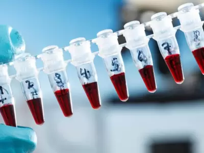 Coronavirus-2