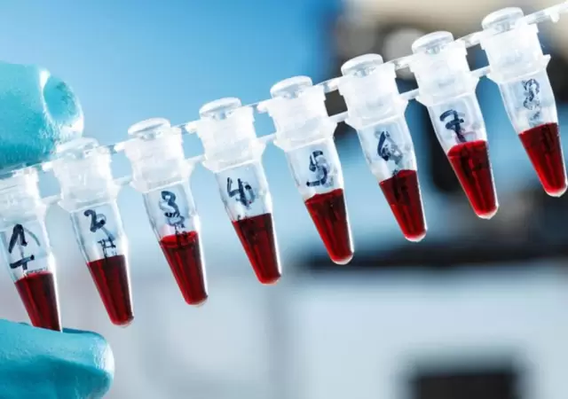 Coronavirus-2