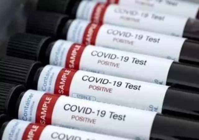 Argentina-coronavirus