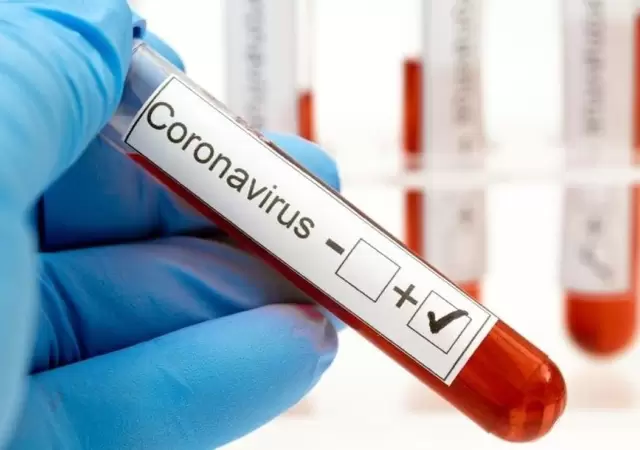 coronavirus-Mendoza