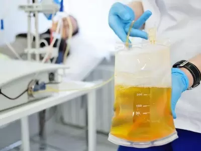plasma-tratamiento-argentina