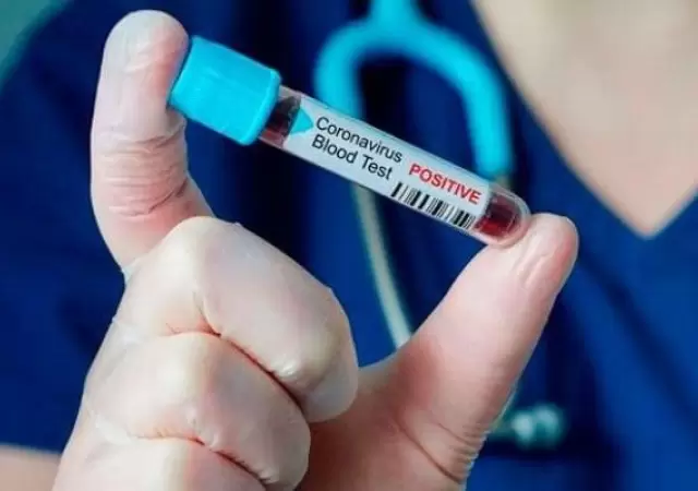 coronavirus-mendoza