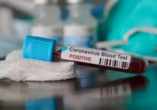 mendoza-coronavirus