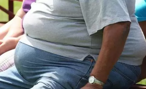 Obesidad