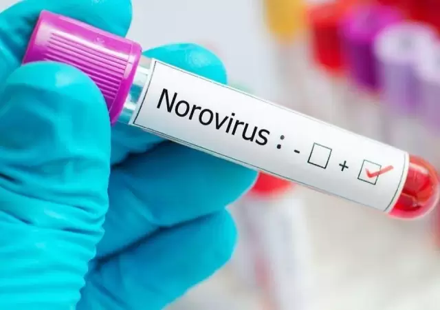 Norovirus