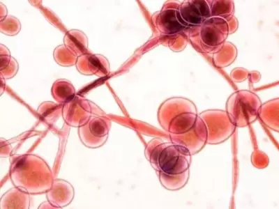 candida-auris-hongo-brasil
