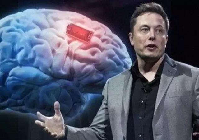 elon-musk-neuralink-chip