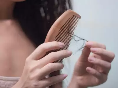 ca�da-pelo