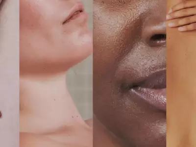 contenful_skin2x