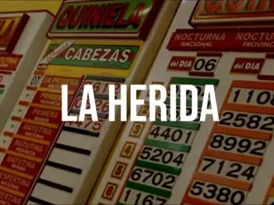 la-herida-quiniela-sueo-suerte-herido-nmero-tabla