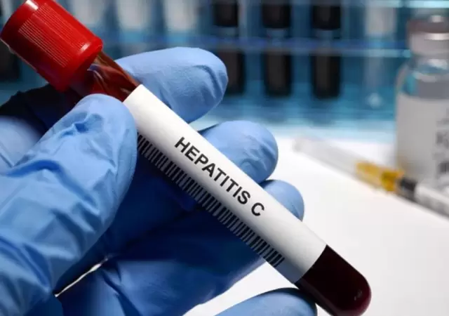 hepatitis-jpg.