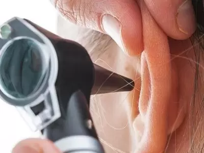 otitis-jpg.