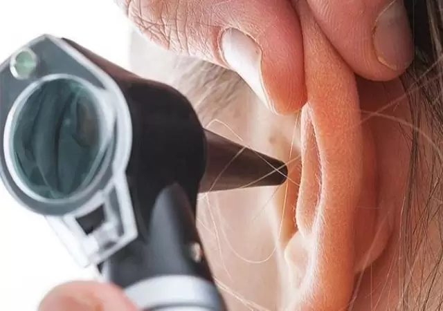 otitis-jpg.