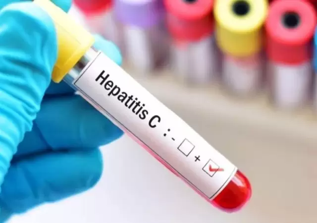 hepatitis-jpg.