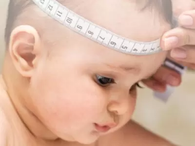 img-destacada-infantil-hidrocefalia-960x750-jpg.