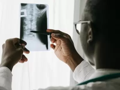 osteoporosis-jpg.