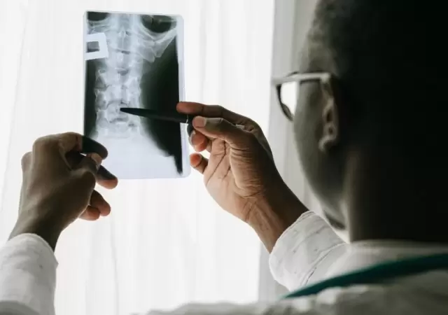 osteoporosis-jpg.