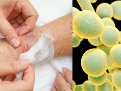 hongo-candida-auris-png.