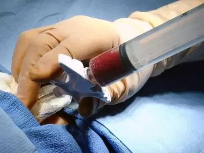 medula-jpg.