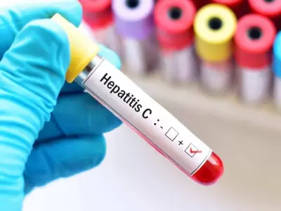 hepatitis-c-jpg.