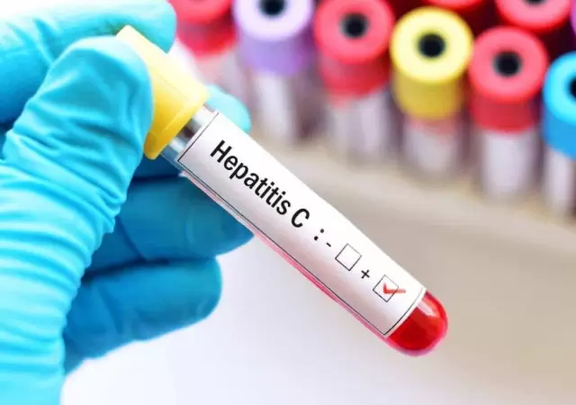 hepatitis-c-jpg.