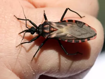 chagas-png.