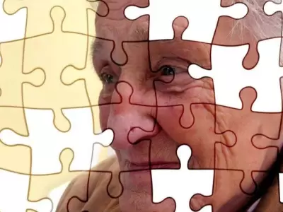 alzheimer-jpg.