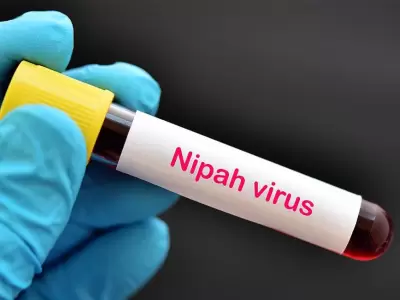 Adolescente muere por virus Nipah en India: una nueva amenaza pandmica?