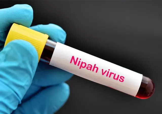 Adolescente muere por virus Nipah en India: una nueva amenaza pandmica?