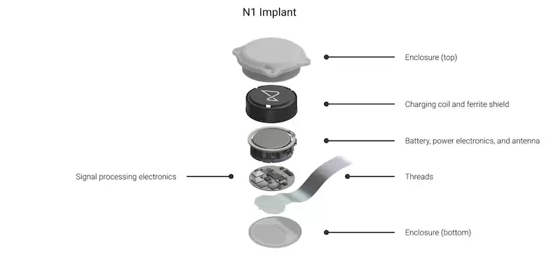 Neuralink dice que prob con xito en un segundo voluntario su chip, que se inserta en el cerebro y permite controlar una computadora con la mente.