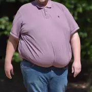 Obesidad en Estados Unidos: un problema que cuesta 173 mil millones de d�lares