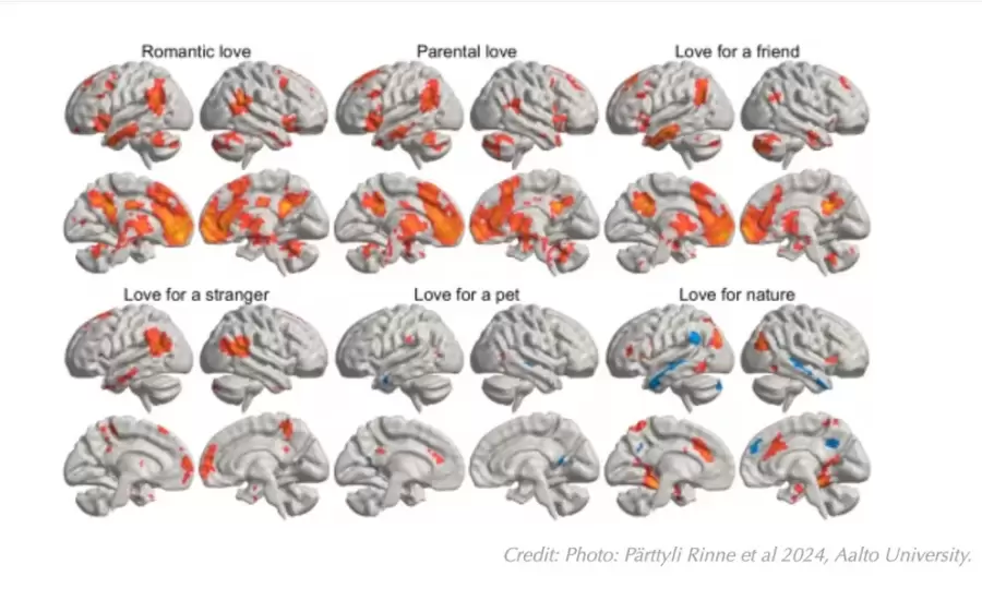 cerebro (1)