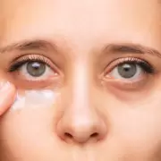 Este es el mtodo para despedirte de las ojeras de manera eficaz y natural