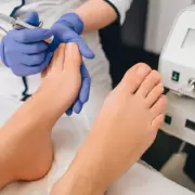 Con este remedio casero podr�s eliminar los hongos de las u�as de manera definitiva