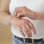 Estrés, genética y psoriasis: cómo se activa y cómo se puede controlar