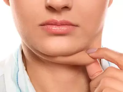 Adi�s a la papada: la vitamina que promete eliminarla en pocos d�as