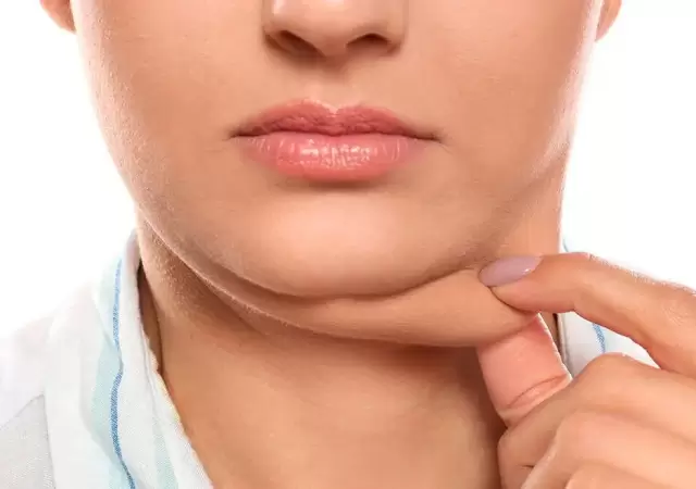 Adi�s a la papada: la vitamina que promete eliminarla en pocos d�as