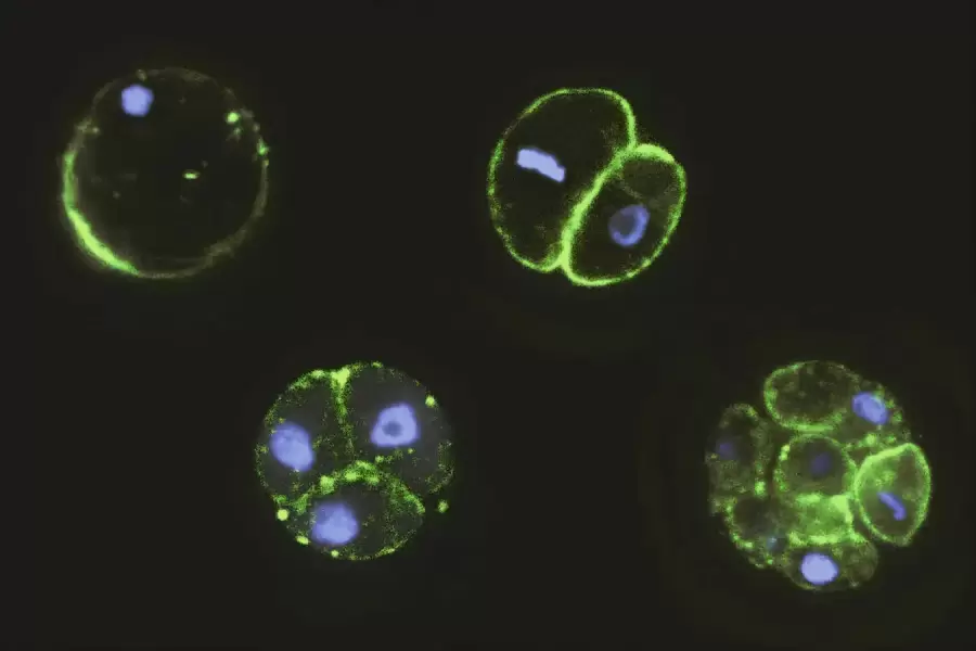Im�genes de la Chronosphera Perkinsii, estudiada en Ginebra.