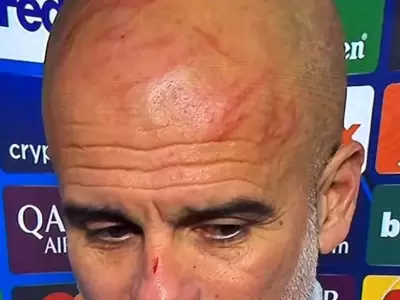 Guardiola se autolastim�.
