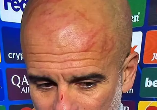 Guardiola se autolastim�.
