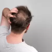 �Hay alimentos que hacen crecer el pelo? Prob� otra forma de recuperar lo perdido